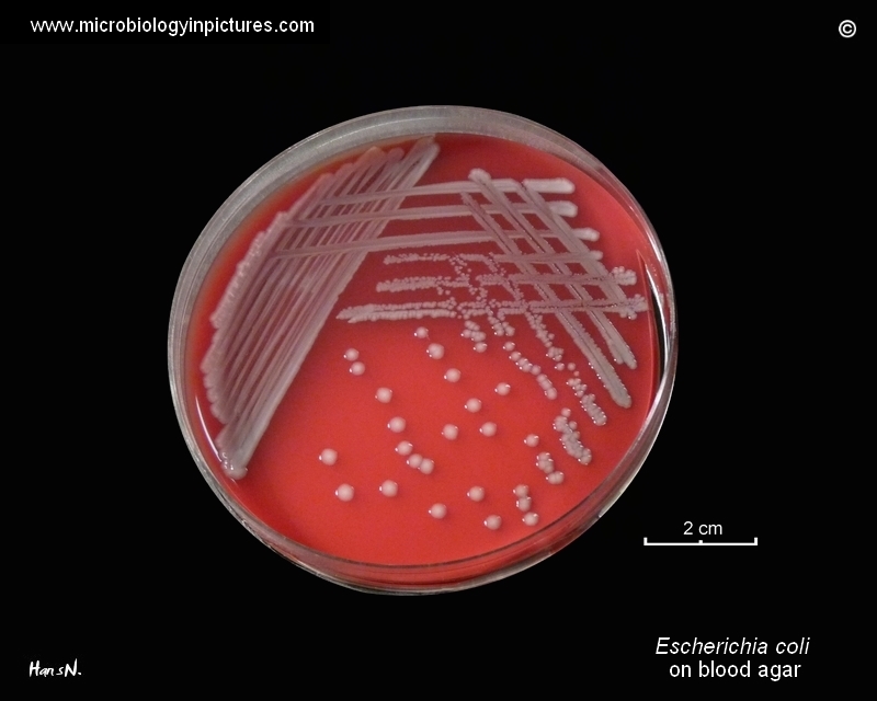 E.coli